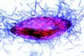 Paramecium, specially prepared and stained to show the trichocysts