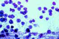Vorticella slide, a common stalked ciliate