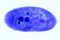 Balantidium coli slide, human parasite slide