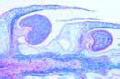 Lycopodium slide, t.s. of mature sporophyll