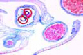 Selaginella slide, l.s. of strobilus