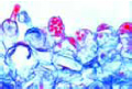Fern prothallium, section with antheridia