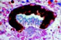 Planaria, section selected to show the ocelli