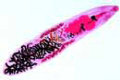 Dicrocoelium lanceolatum slide (D. dendriticum)