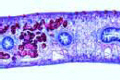Fasciola hepatica, t.s. through the body