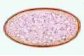 Fasciola hepatica, ova w.m.