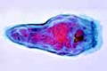 Fasciola hepatica, miracidia (free living larvae)