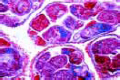Schistosoma mansoni, cercaria with bifurcate tail