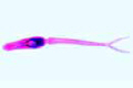 Schistosoma mansoni, section through infected snail liver