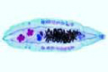 Clonorchis sinensis slide, Chinese liver fluke slide