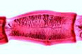 Taenia saginata slide, selected mature proglottids
