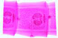 Taenia pisiformis slide, mature proglottids