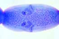 Dipylidium caninum slide, mature proglottids