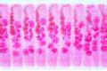 Hymenolepis nana slide, dwarf tapeworm of rats