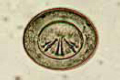 Hymenolepis nana slide, ova from faeces