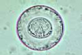 Hymenolepis diminuta slide, ova