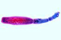 Echinococcus granulosus slide, tapeworm of dogs