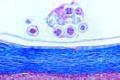 Echinococcus granulosus, cyst wall and scolices