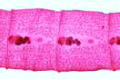 Diphyllobothrium latum slide, mature proglottids
