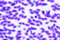 Lacerta, lizard, blood smear slide