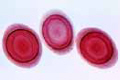 Plumatella slide, isolated statoblasts