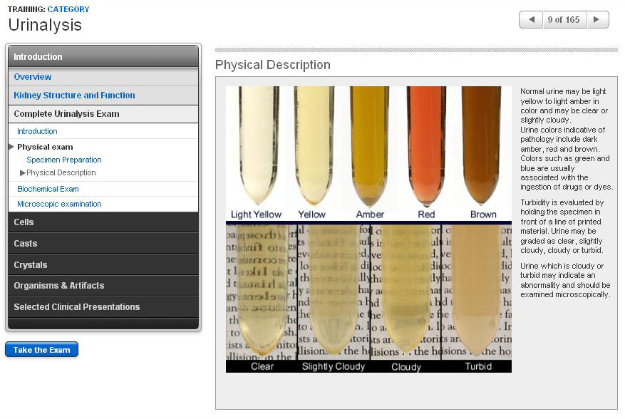 Urinalysis Sample Screens