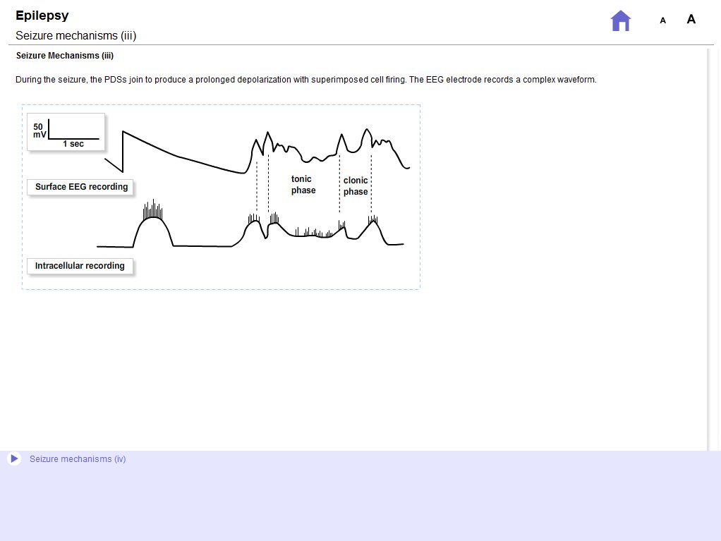 Epilepsy Sample Screens